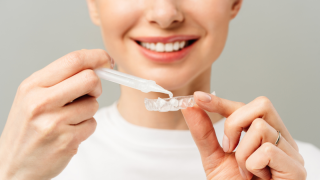 Teeth Whitening: What You Need to Know